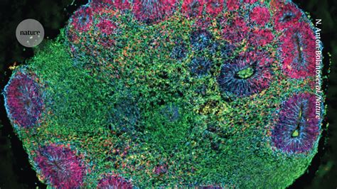 These 3D model brains with cells from several people are first of .